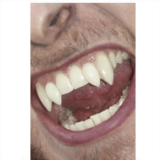 Smiffy's Scarecrow Deluxe Werewolf Fangs