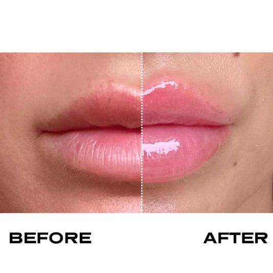 Plump It! No Needles Lip Filler Kit - 2 Pack