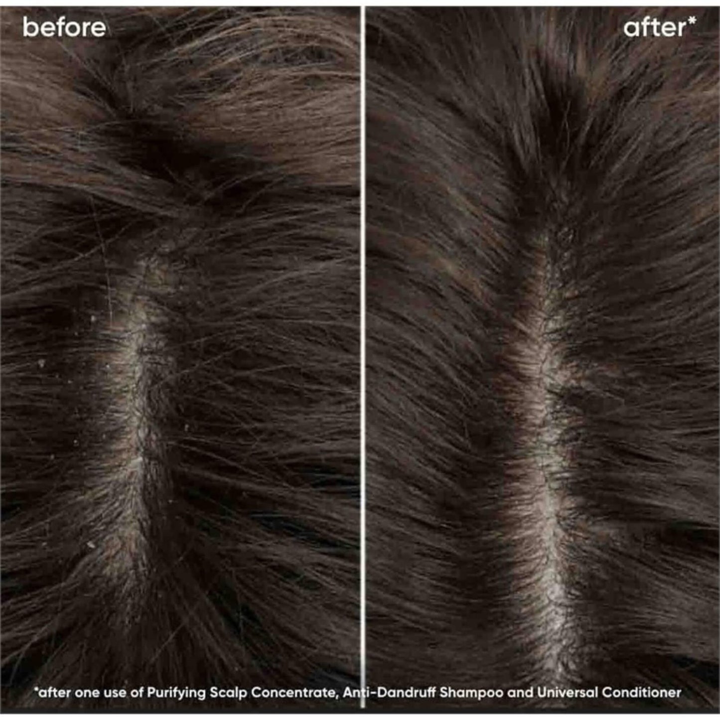 Biolage Scalp Sync Universal Conditioner - 200ml