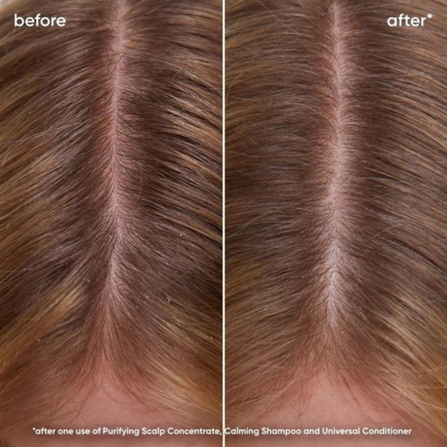 Biolage Scalp Sync Calming Shampoo