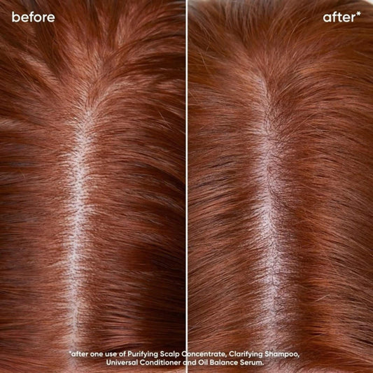 Biolage Scalp Sync Oil Balancing Serum - 50ml