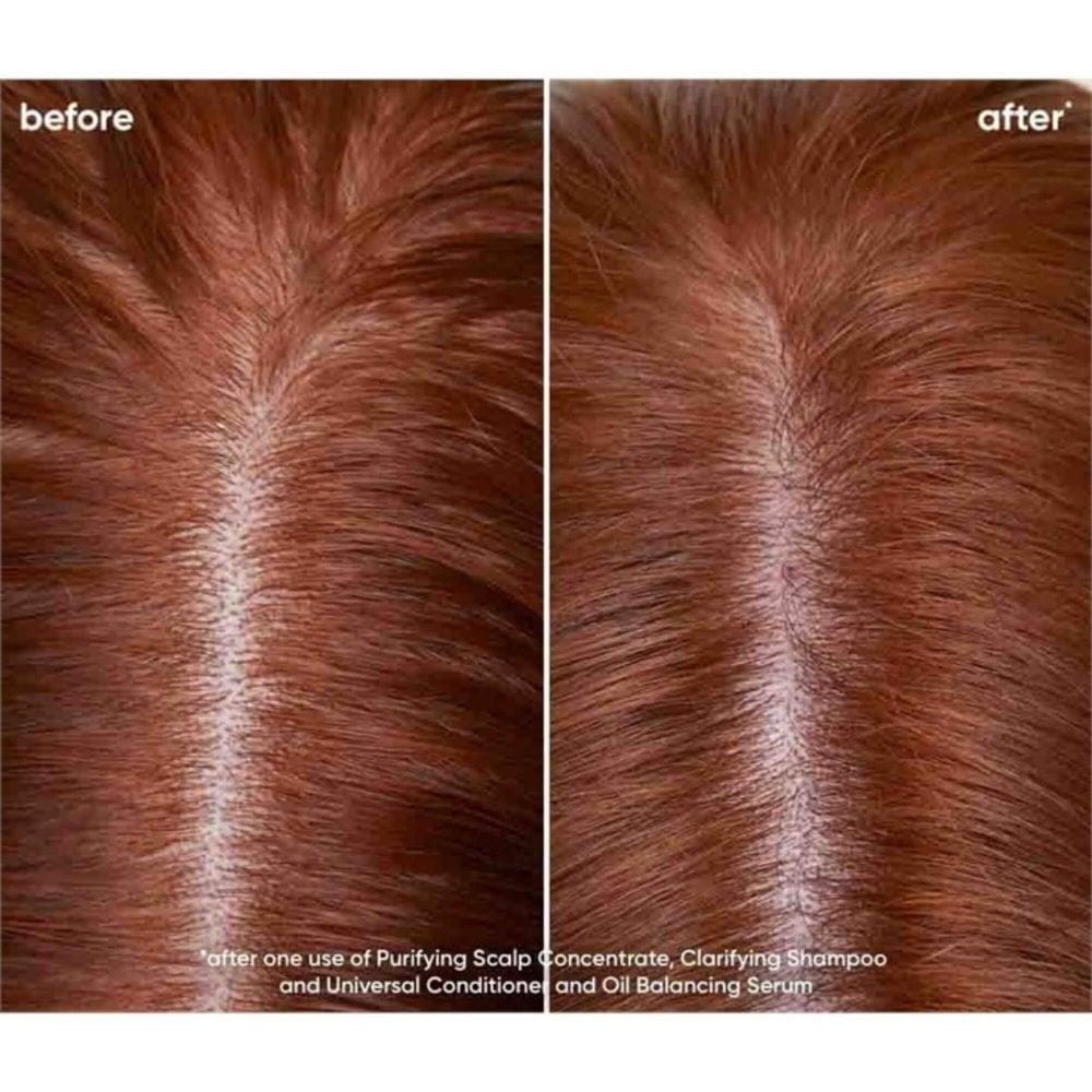 Biolage Scalp Sync Clarifying Shampoo