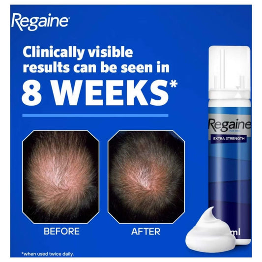 Regaine For men Extra Strength Foam Set - 3 x 73ml