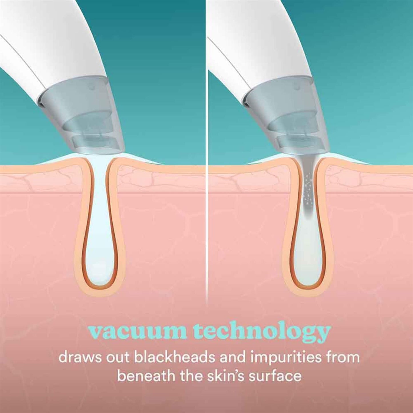 Homedics Ionic Hydra Facial Cleansing Device